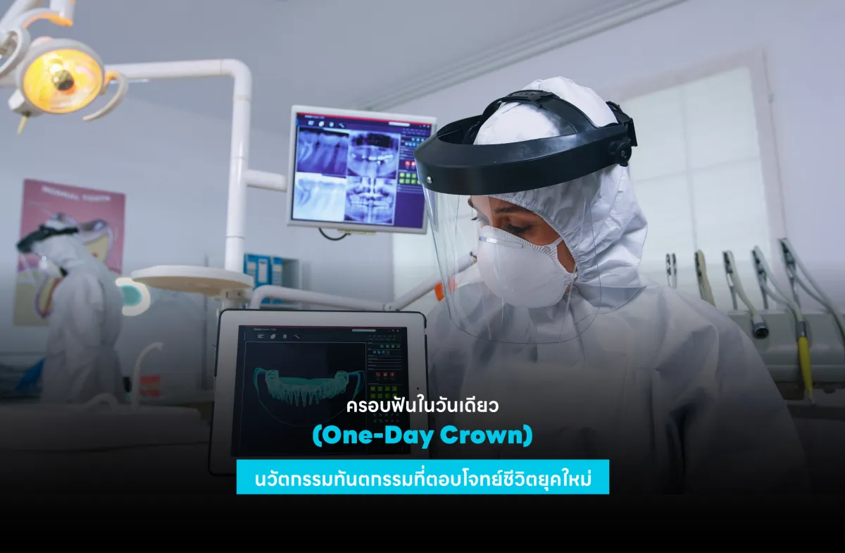 ครอบฟันในวันเดียว (One-Day Crown) นวัตกรรมทันตกรรมที่ตอบโจทย์ชีวิตยุคใหม่