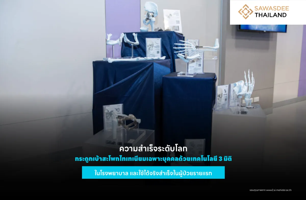 ความสำเร็จระดับโลก กระดูกเบ้าสะโพกไทเทเนียมเฉพาะบุคคลด้วยเทคโนโลยี 3 มิติในโรงพยาบาล และใช้ได้จริงสำเร็จในผู้ป่วยรายแรก