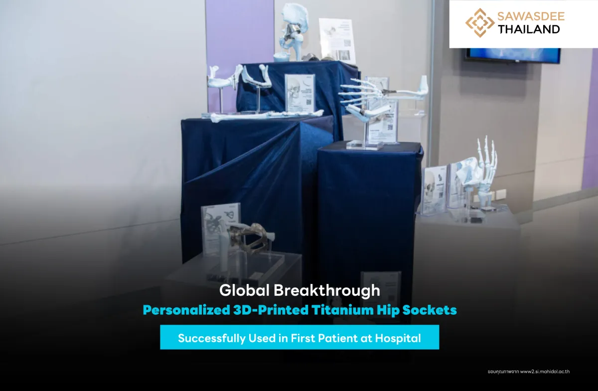 Global Breakthrough: Personalized 3D-Printed Titanium Hip Sockets Successfully Used in First Patient at Hospital