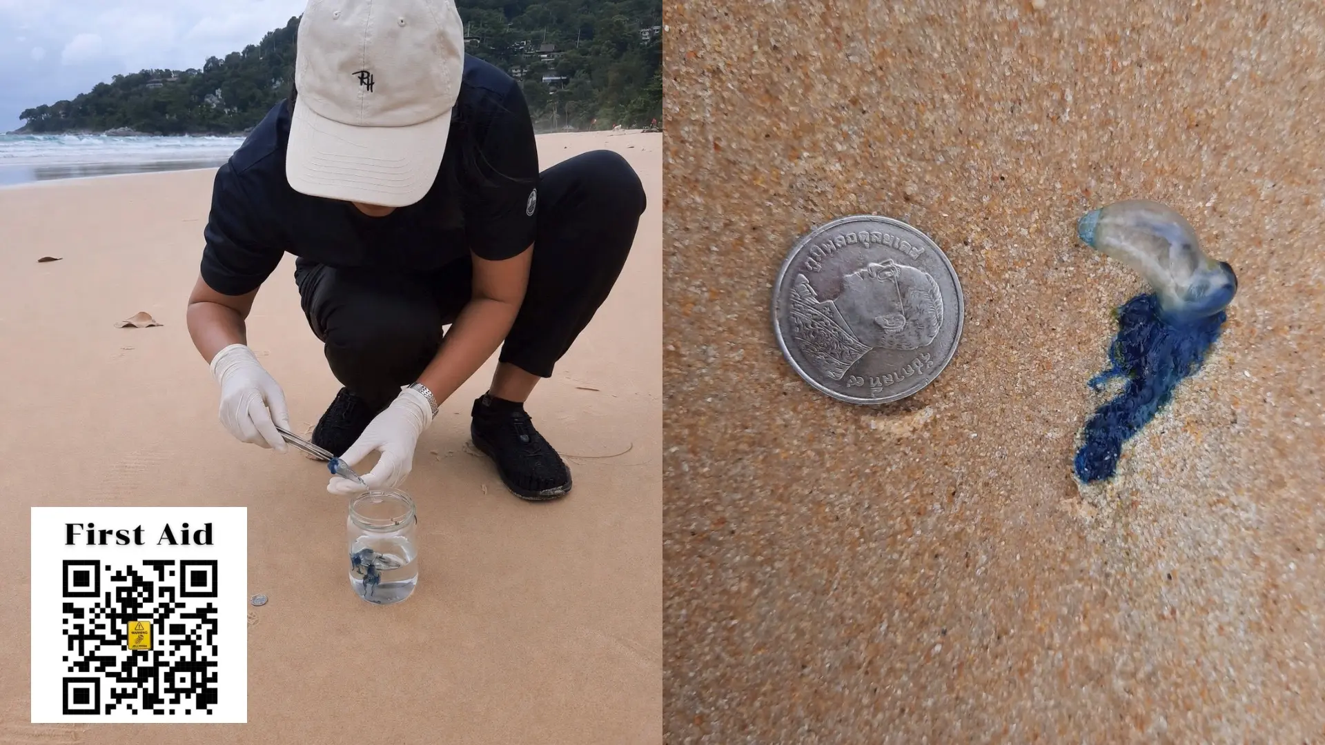 Minister Suchart Chomklin Expresses Concern for Tourist Safety, Orders Coastal Monitoring Following Bluebottle Jellyfish Wash-Up at Karon Beach in Phuket